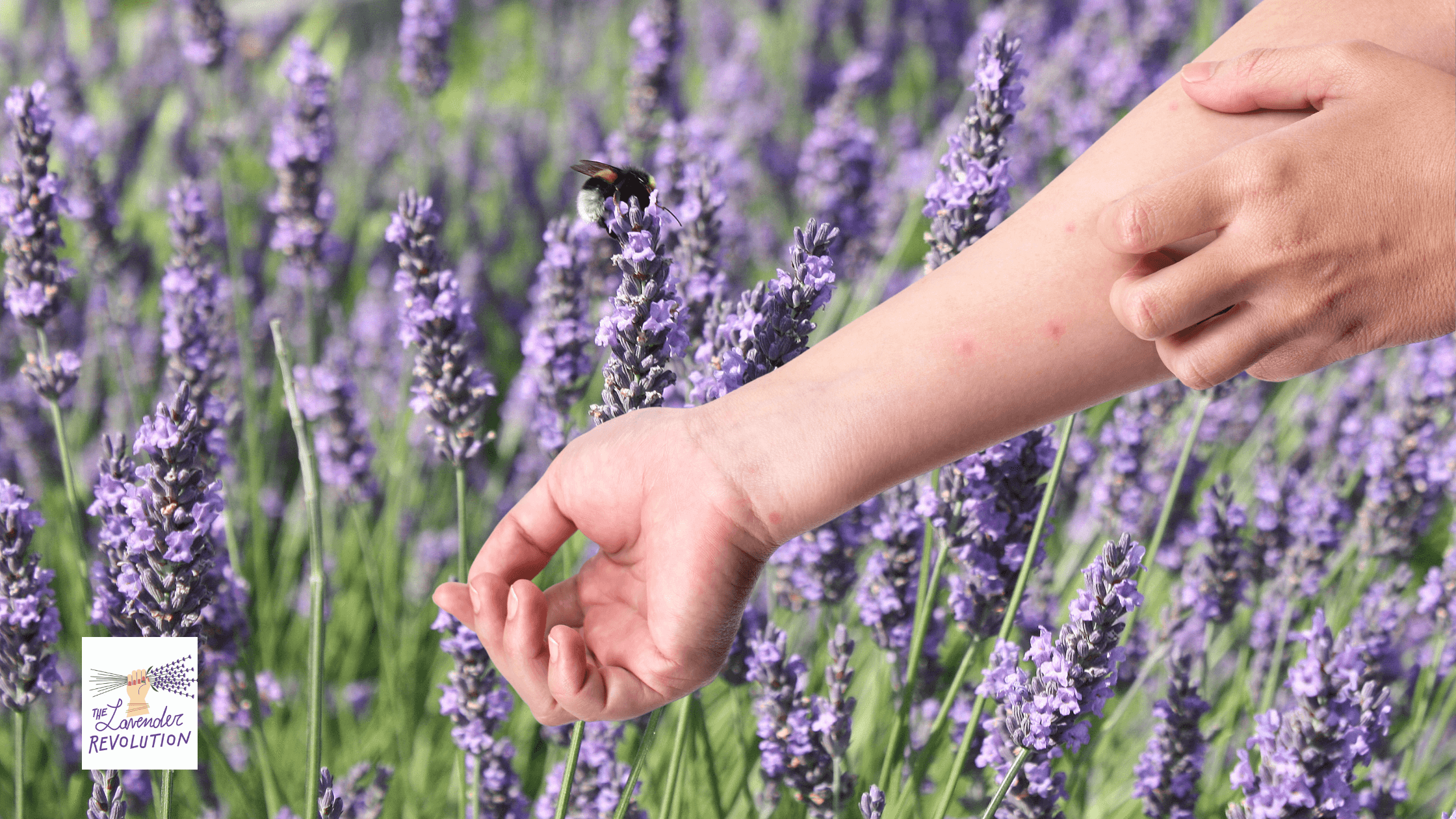 La Lavanda un rimedio naturale per le punture d'insetto