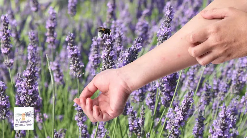 punture-insetto-zanzare-lavanda-braccio-campo